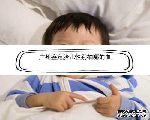 广州4个月能鉴定宝宝性别不_香港验血查性别报告单怎样看,验血结果有y染色体